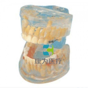 “康為醫療”透明乳牙發育模型(保隙裝置模型)