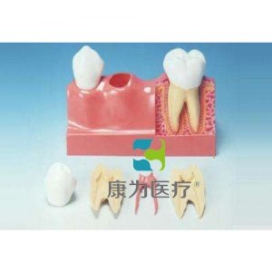 “康為醫療”牙分解模型（4倍大）